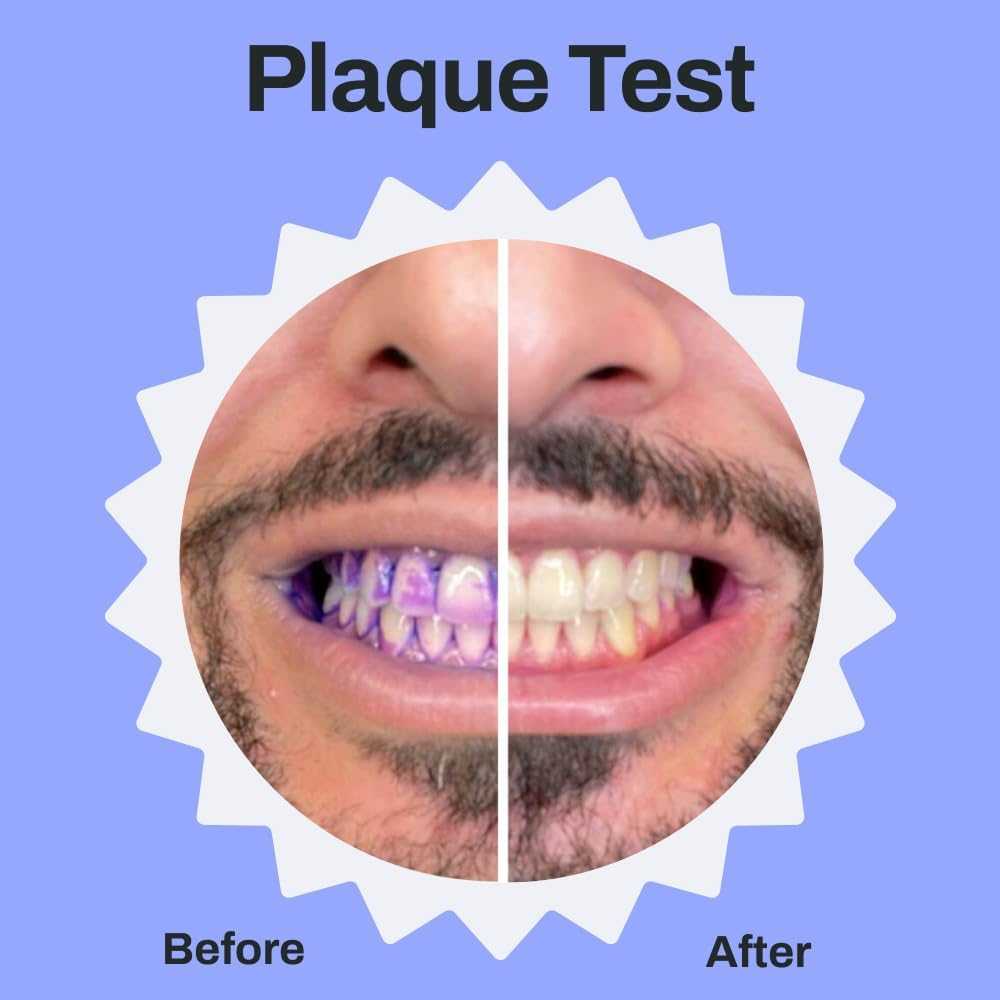 Before and after plaque test showing teeth cleaned using the Autobrush U-shaped electric toothbrush