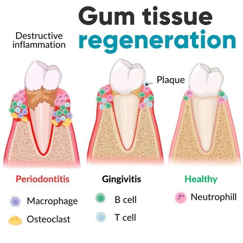 DentiZen™ Gel de thérapie gingivale