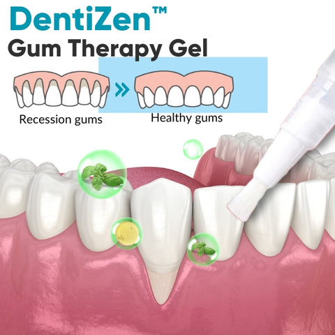 DentiZen™ Gel de thérapie gingivale