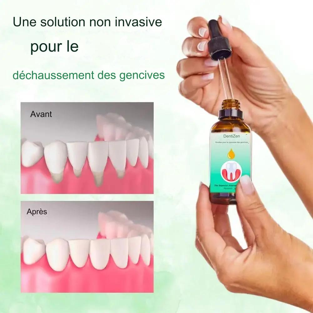 Gel de thérapie gingivale